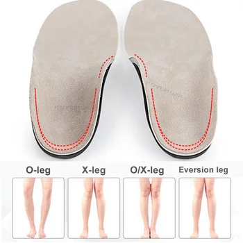 Çocuk Çocuk Ortopedik Tabanlık Arch Destek Düz Ayaklar için Ayakkabı Pedleri Eklemek O / X Tipi Bacak Varus Ortez Yastık Ayak düzeltici 0