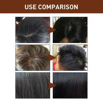 1 adet Doğal Bitki Hafif Temizleme Formülü Zencefil Saç Büyüme Ürünleri Şampuan Sabun Polygonum Özü Şampuan Gri Saç Onarım