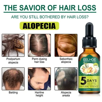 Saç Büyüme Ürünleri 5 Gün Zencefil Hızlı Büyüyen Saç uçucu yağ Besler Derisi Anti Saç Dökülmesi Onarım Hasarlı Güzellik Saç Bakımı