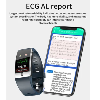 Xiaomi Erkekler Akıllı izle Vücut Sıcaklığı EKG PPG Kalp Hızı Kan Basıncı / Oksijen Spor İzci Bilezik Kadın Spor SmartWatch 2