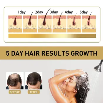 Zencefil Şampuanı Anti Beyaz şampuan Siyah Saç Bakımı 100ml Şampuan Şampuan Onarım Saç Dökülmesi Doğal Özü Tedavisi Saç N6g0 4